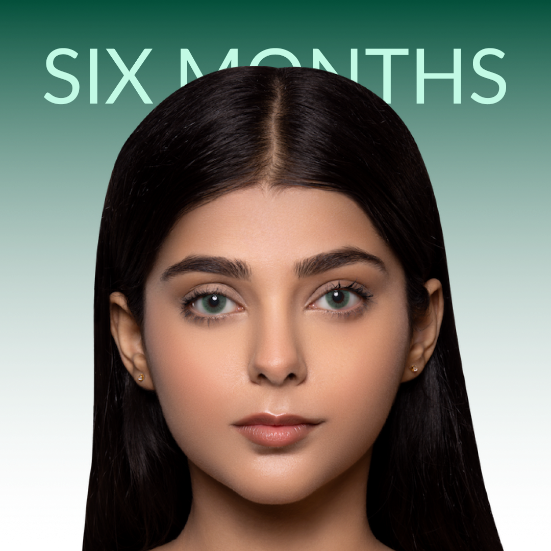 6 Months Lenses